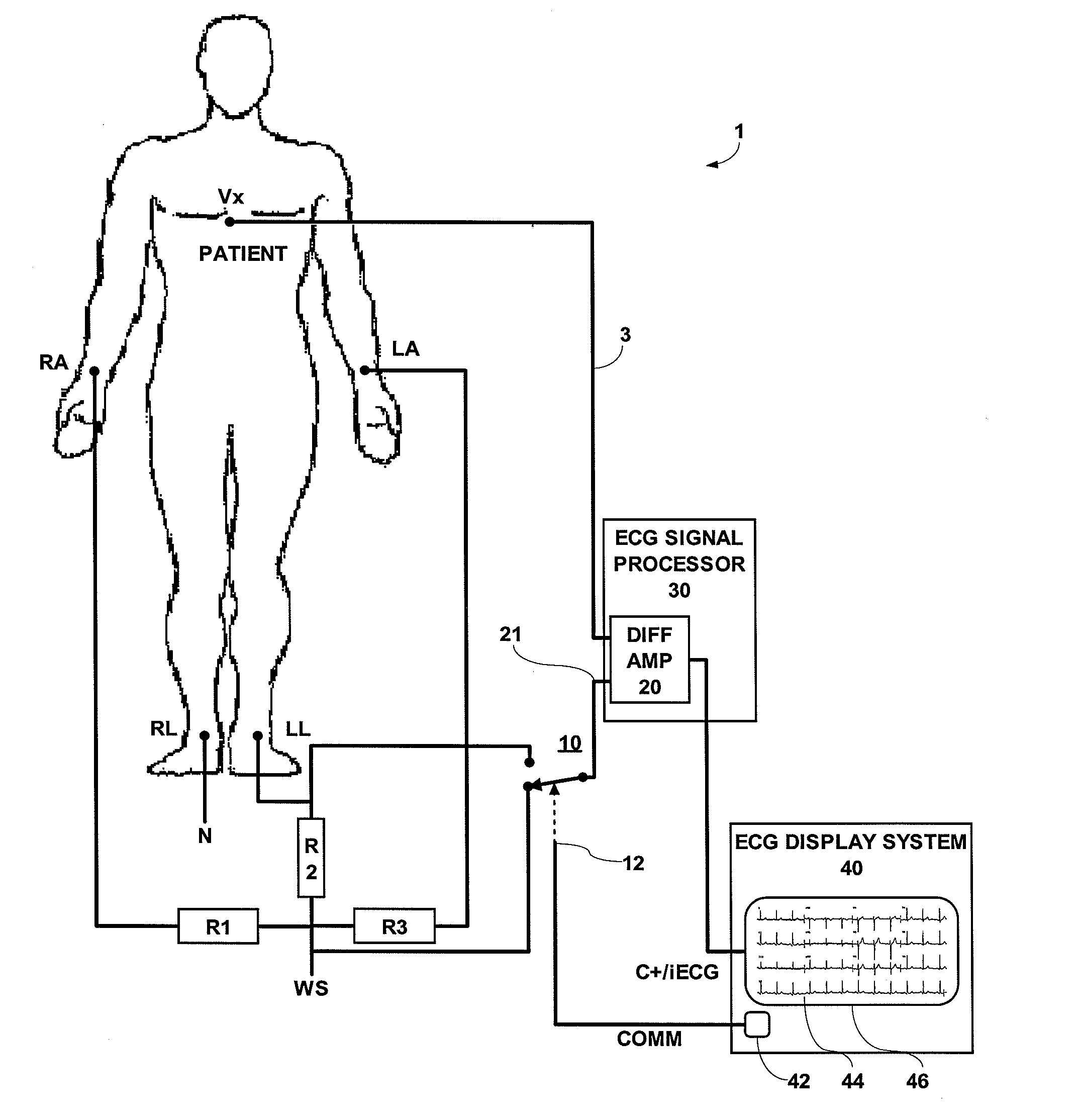 ECG System for Use in ECG Signal Measurement of Intra-Cardiac ECG Using a Catheter