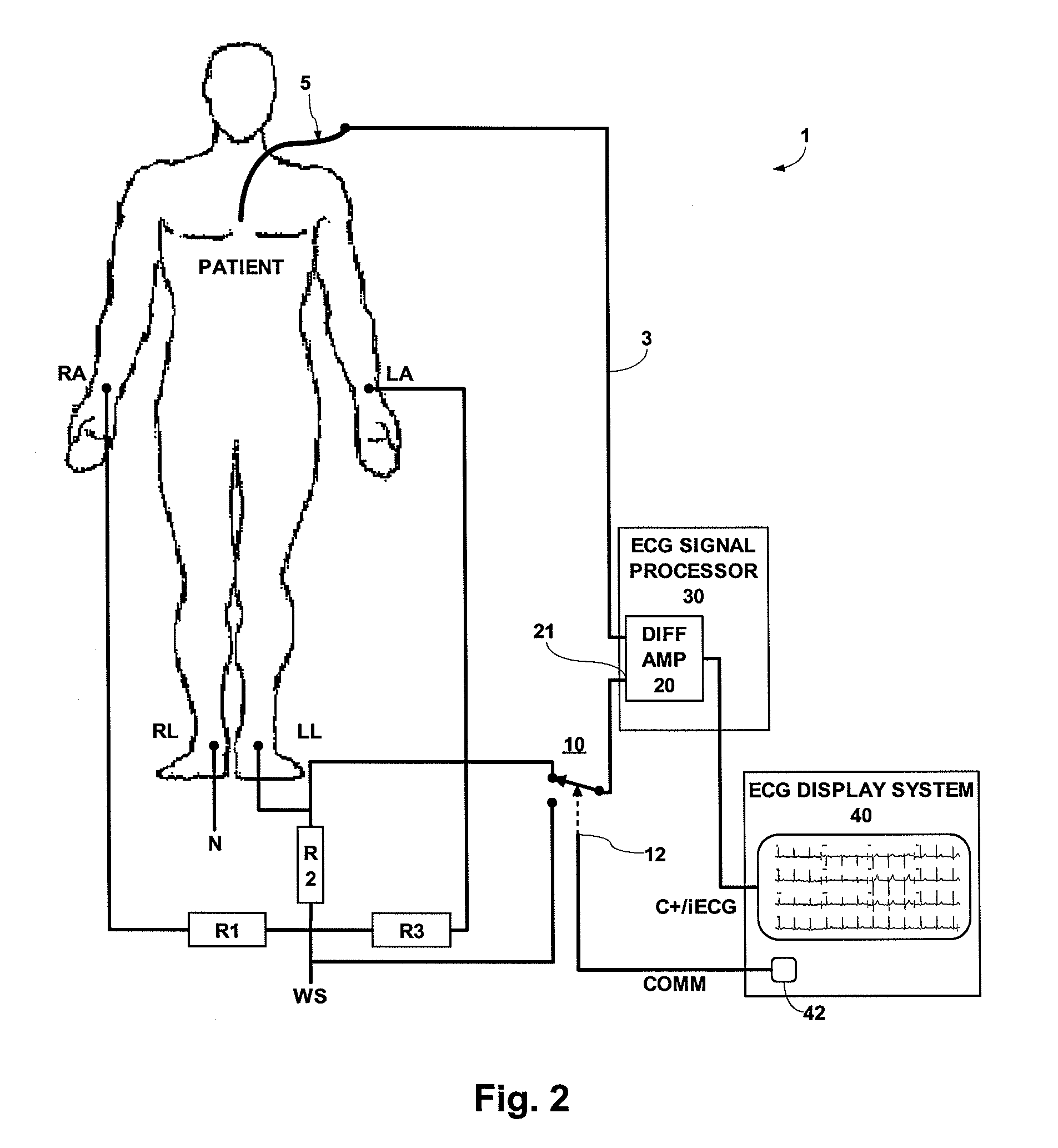 ECG System for Use in ECG Signal Measurement of Intra-Cardiac ECG Using a Catheter