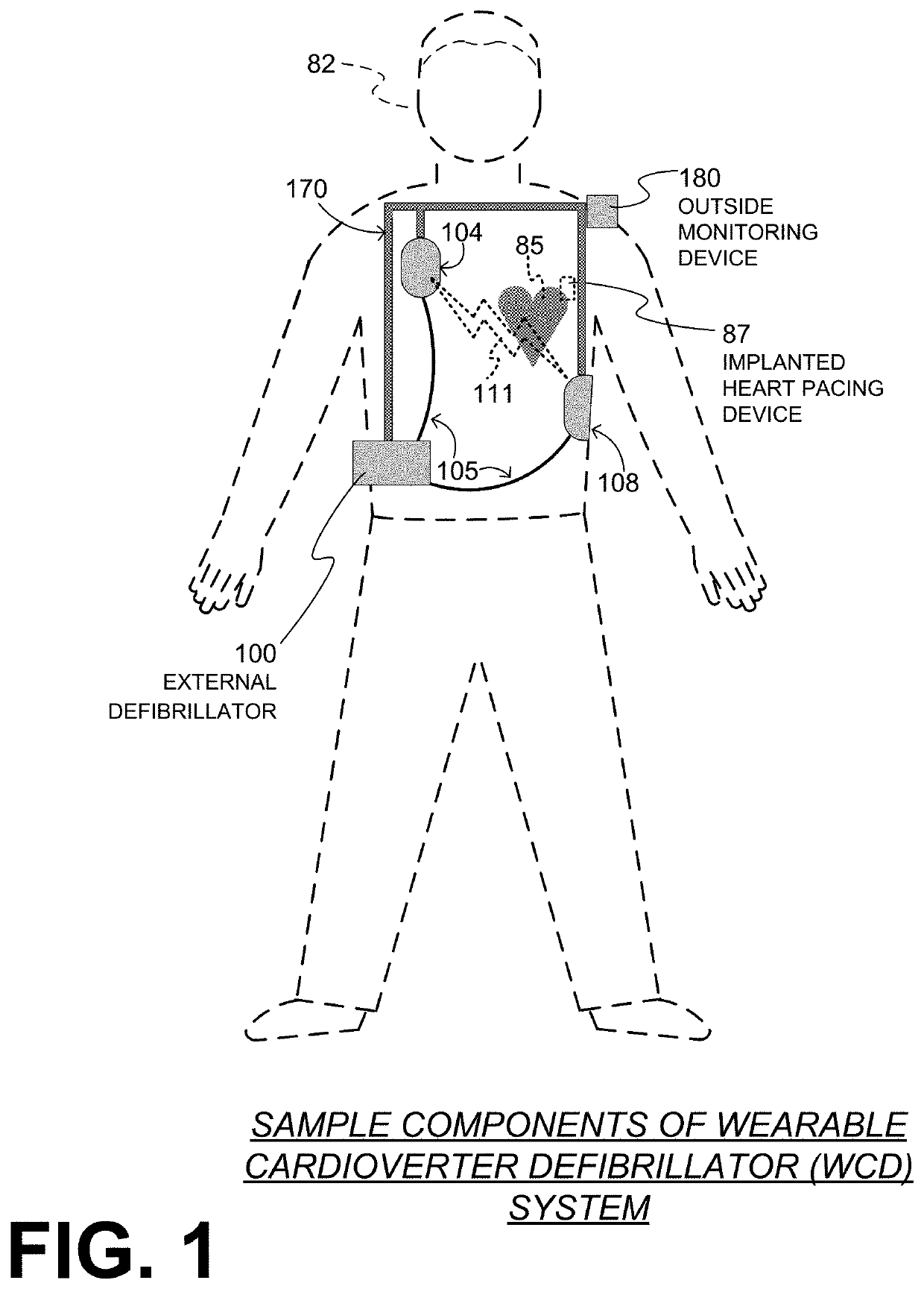 Wearable cardioverter defibrillator (WCD) system selecting previously identified preferred channel for attempting to detect pacing artifacts