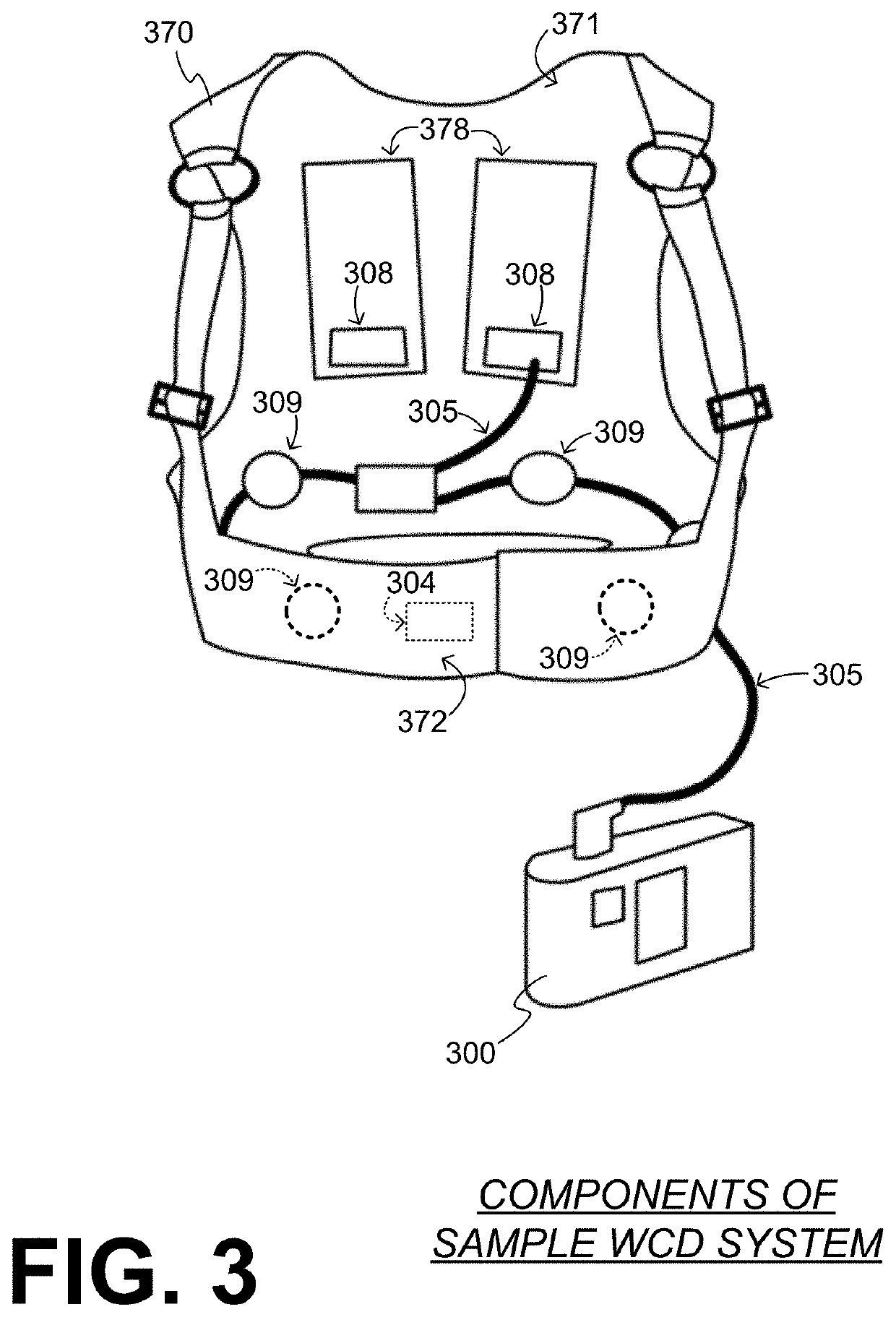 Wearable cardioverter defibrillator (WCD) system selecting previously identified preferred channel for attempting to detect pacing artifacts