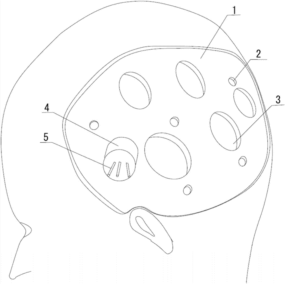 Personalized three-dimensional (3D) printing-based brain seed implantation guidance system