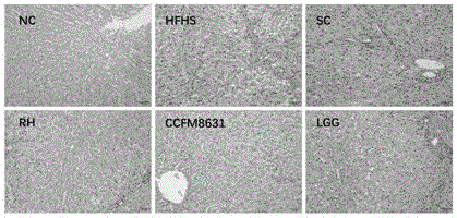 Lactobacillus reuteri and its application