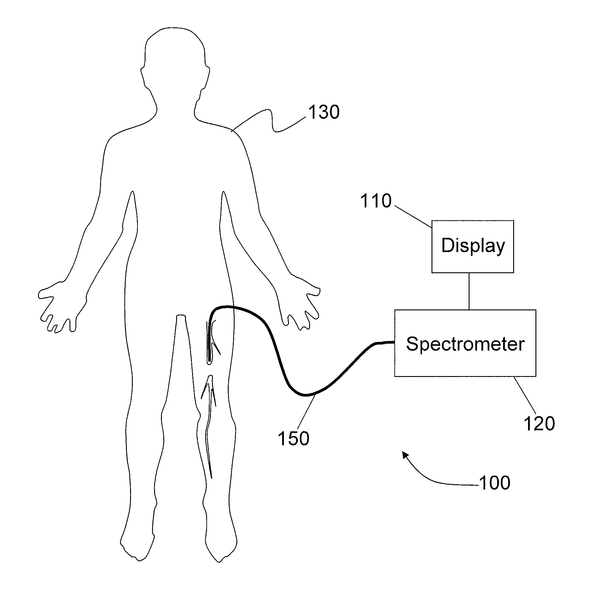 Systems and methods for analysis and treatment of an occluded body lumen