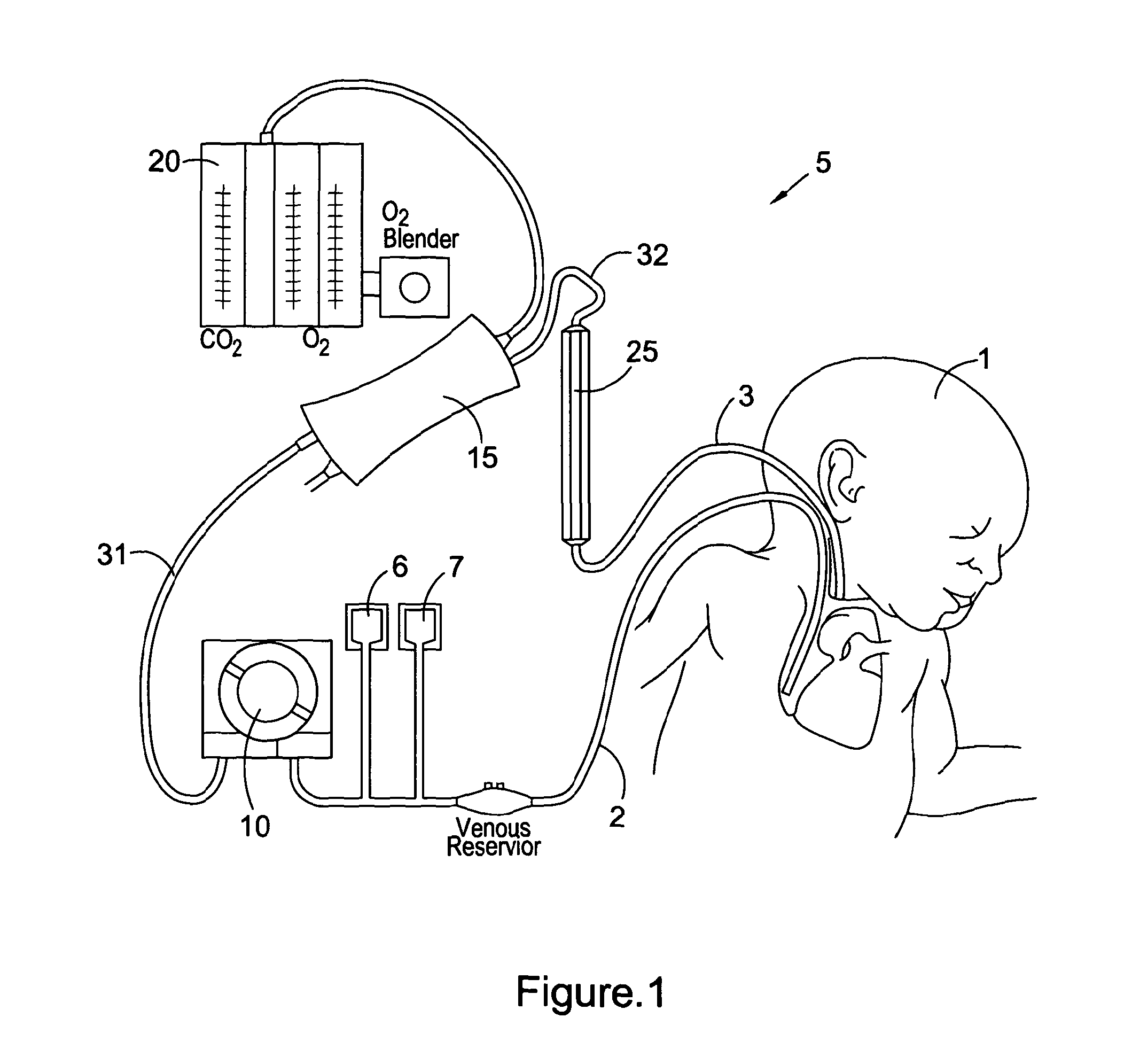 Integrated perfusion device