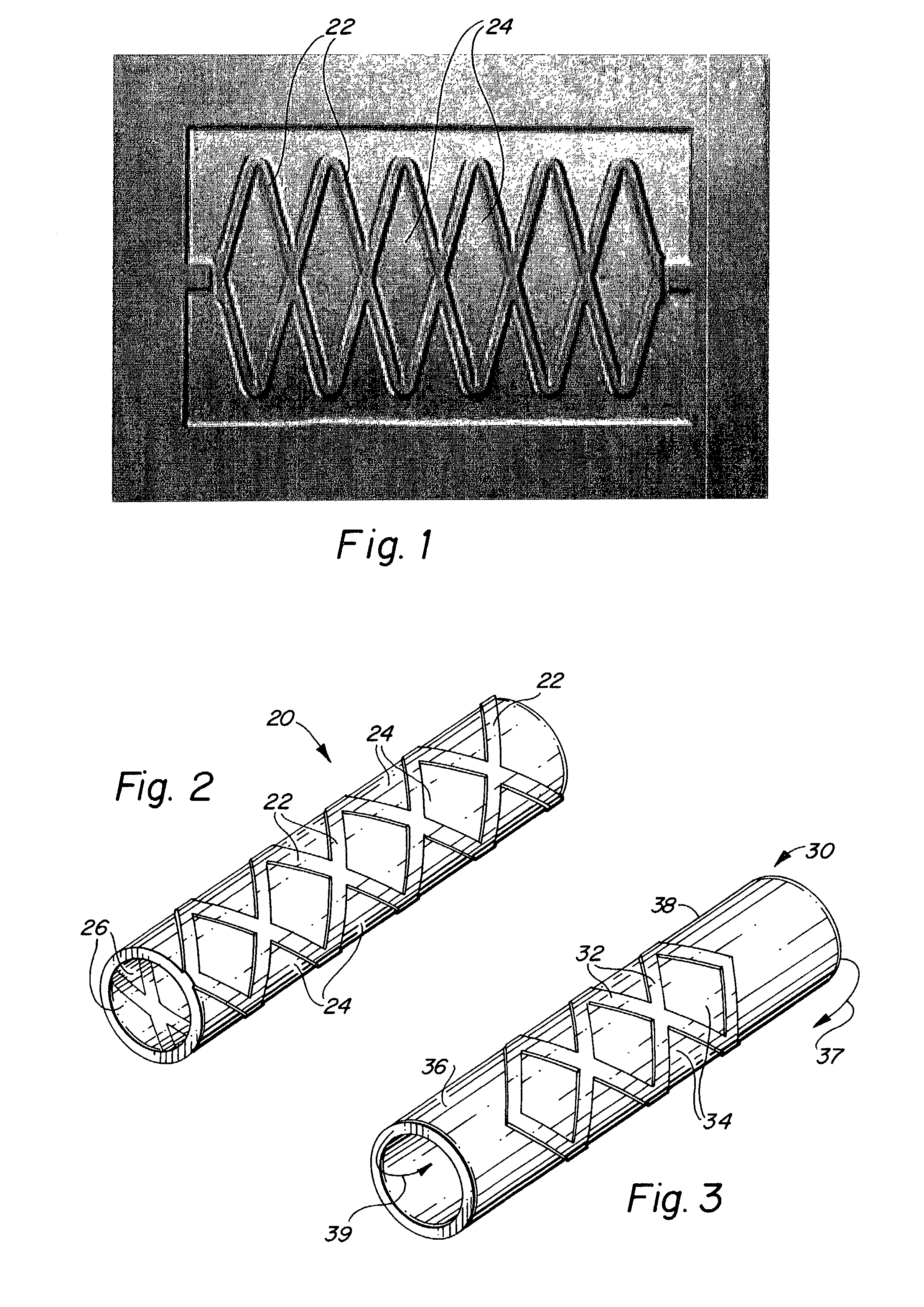 Endoluminal implantable stent-grafts