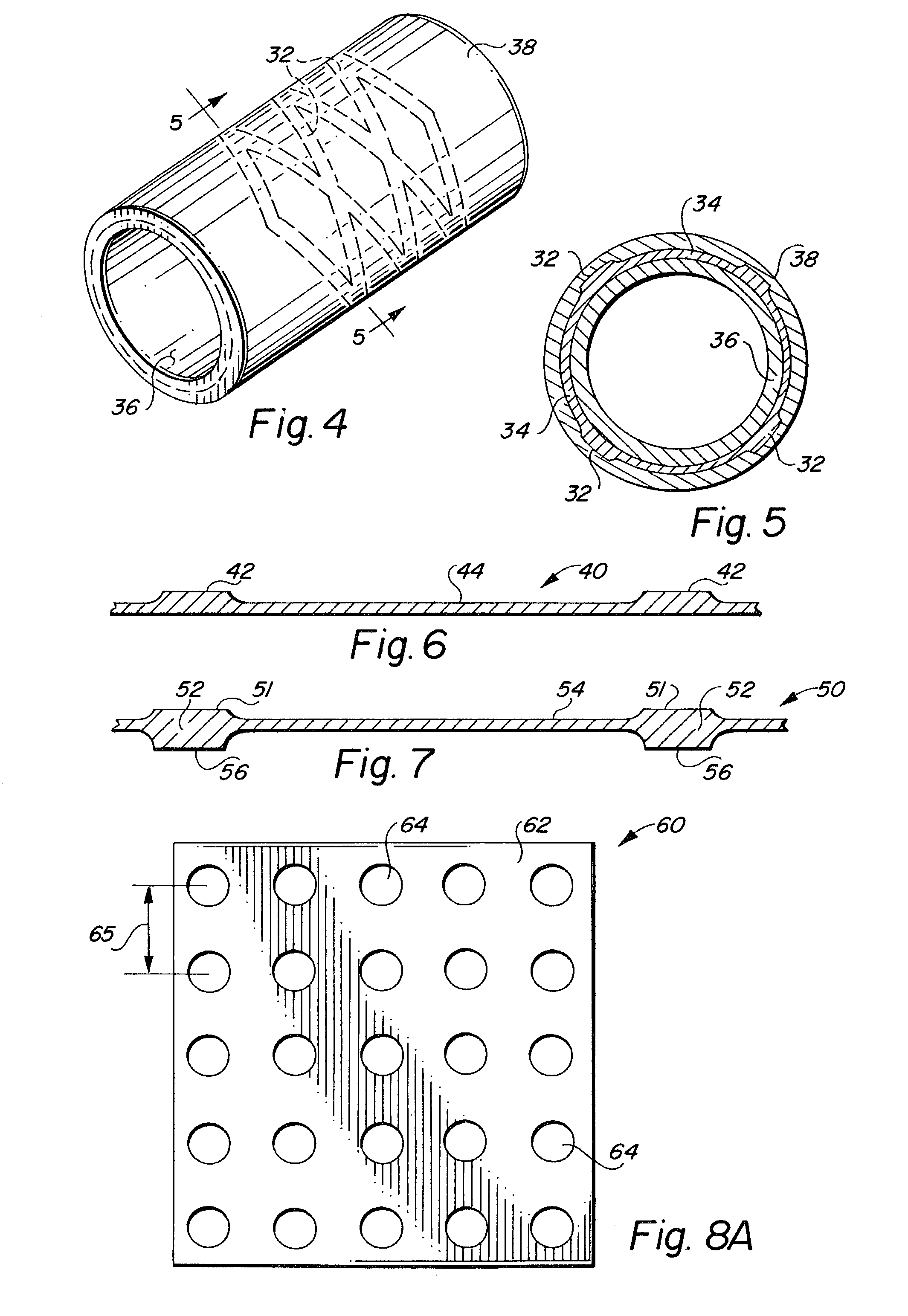 Endoluminal implantable stent-grafts