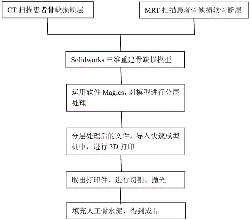 Large bone defect assist bone graft magnesium alloy stent and production method thereof