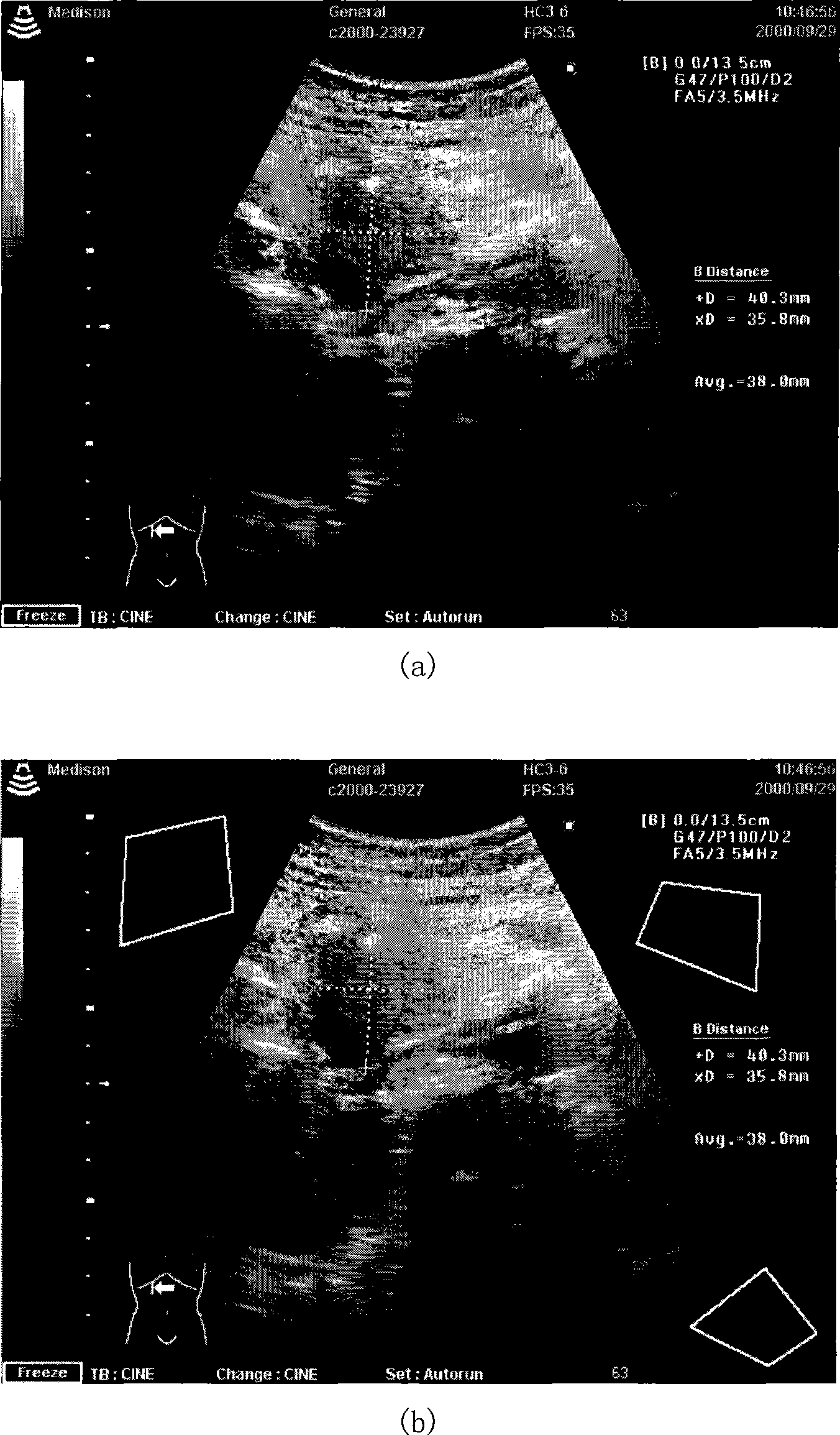 Damage-free digital watermarking based image tampering detection and positioning method