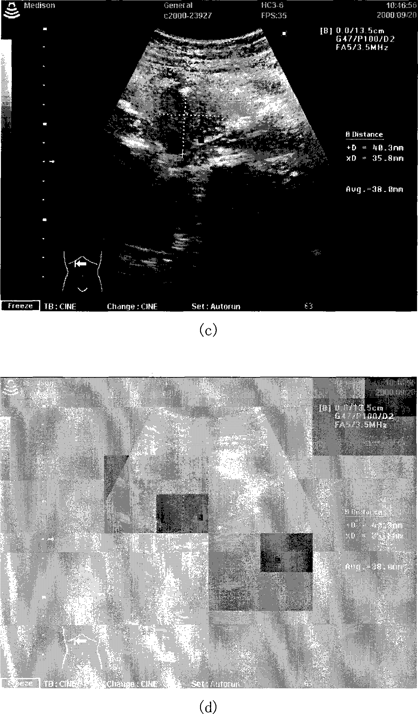 Damage-free digital watermarking based image tampering detection and positioning method