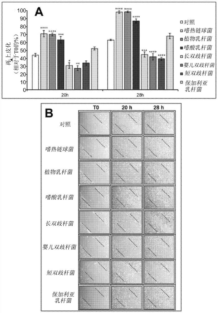 Composition with antibacterial and re-epithelializing action including probiotics