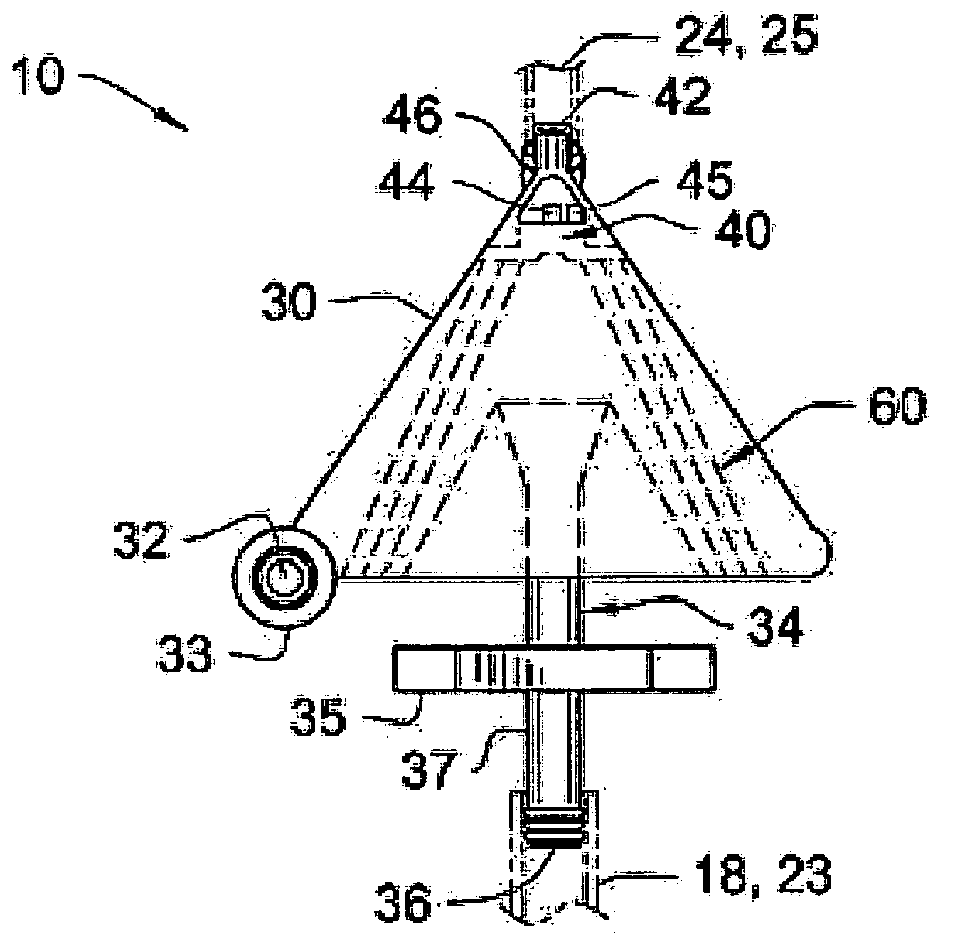 Extracorporeal blood filter system