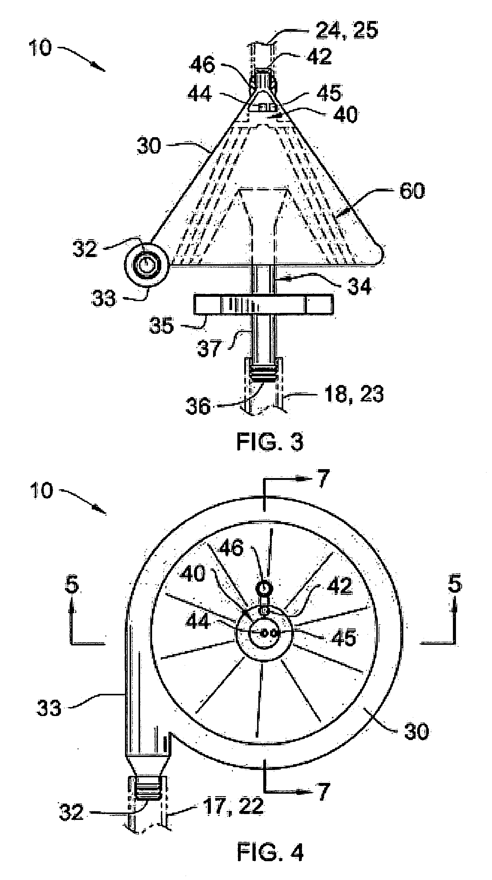 Extracorporeal blood filter system