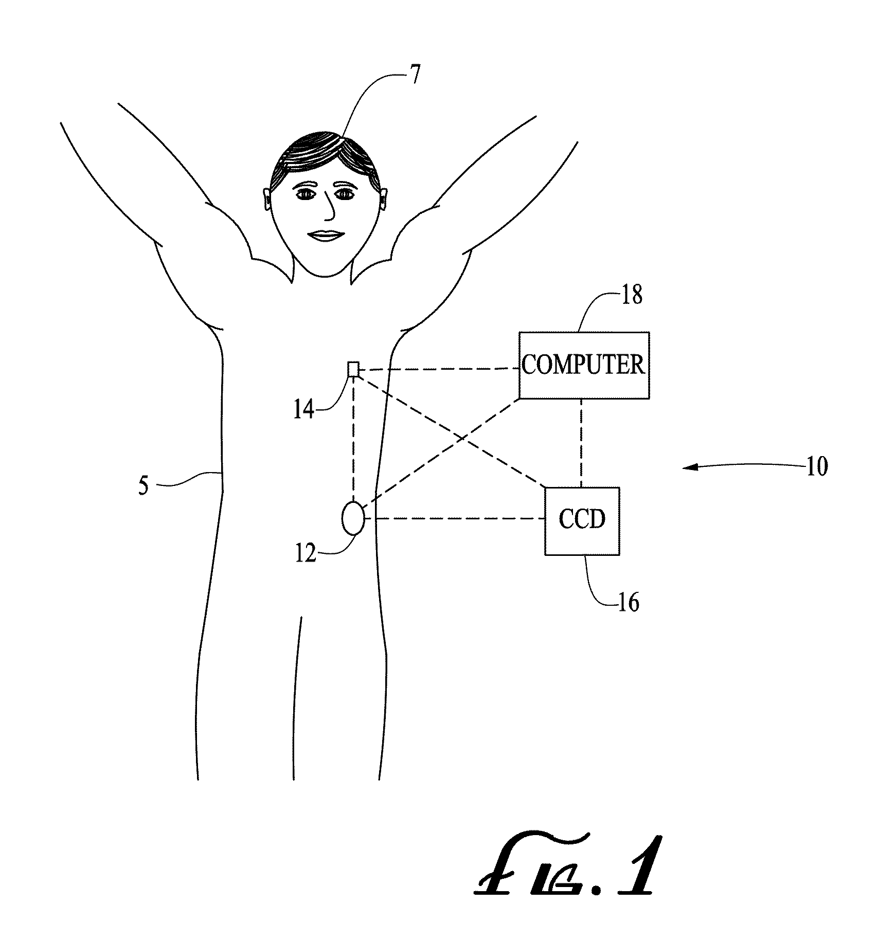 Reservoir plunger head systems and methods