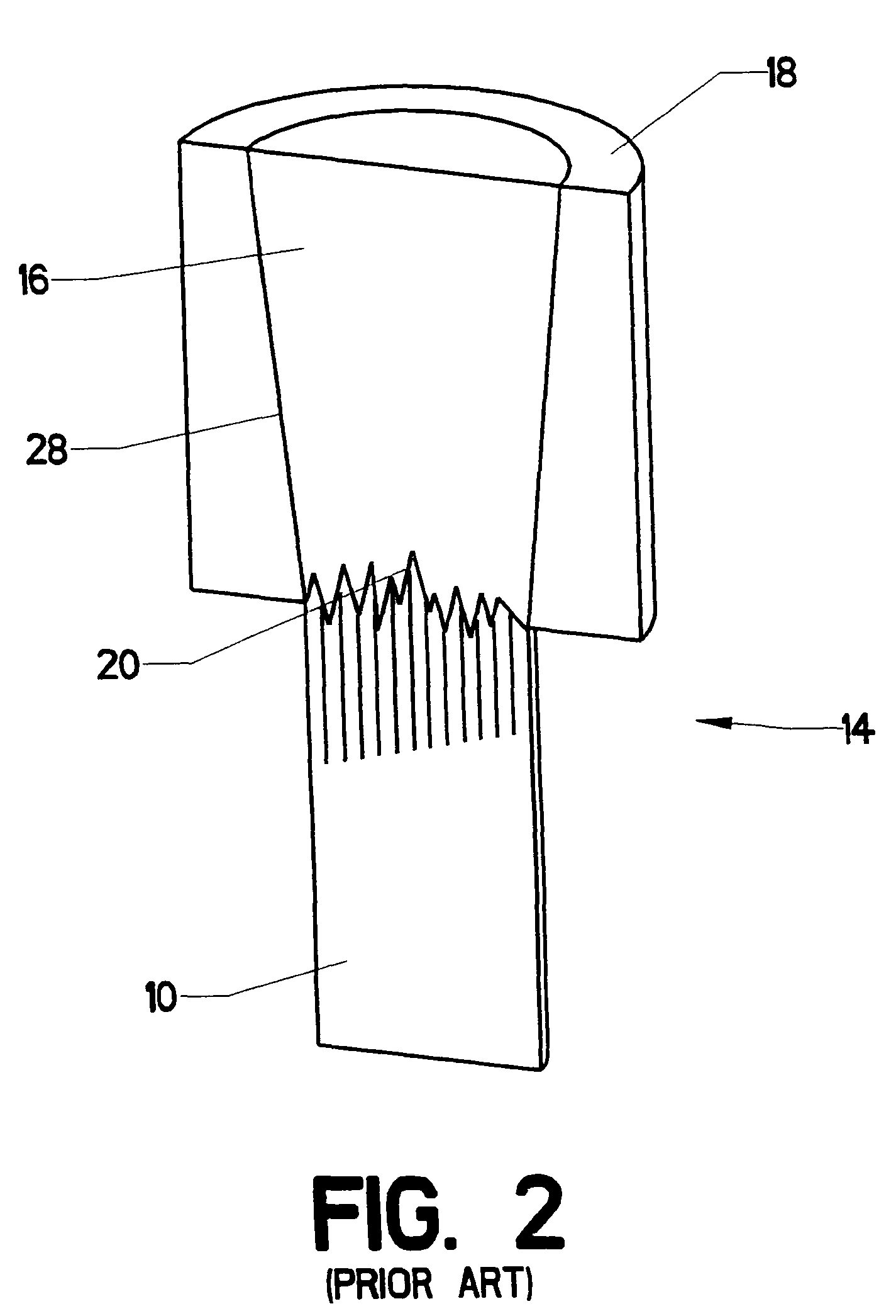 Stress redistributing cable termination