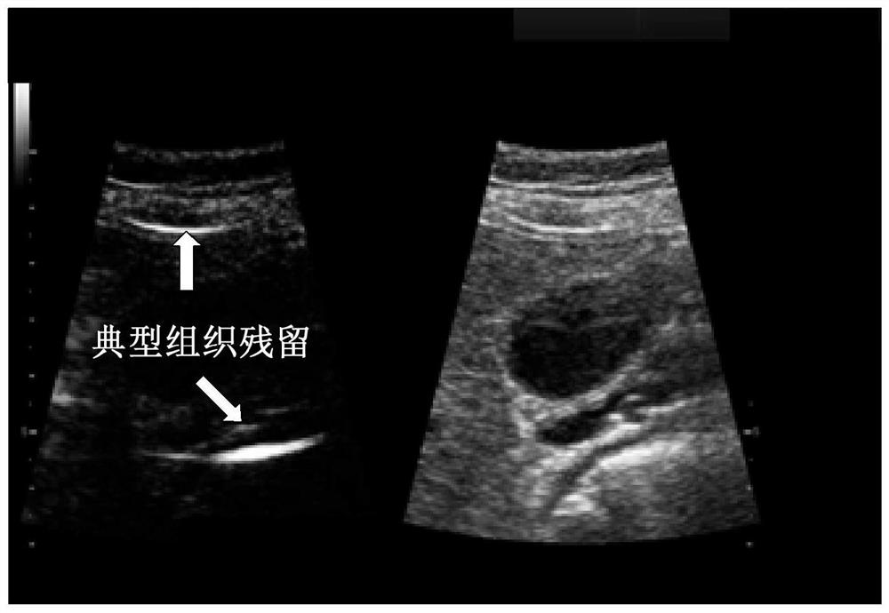 Ultrasonic contrast imaging method and device and storage medium