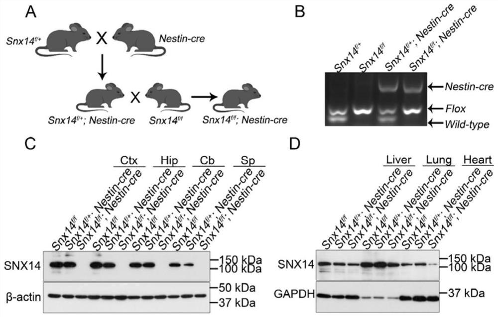 Application of valeric acid derivatives in the treatment of hereditary cerebellar ataxia