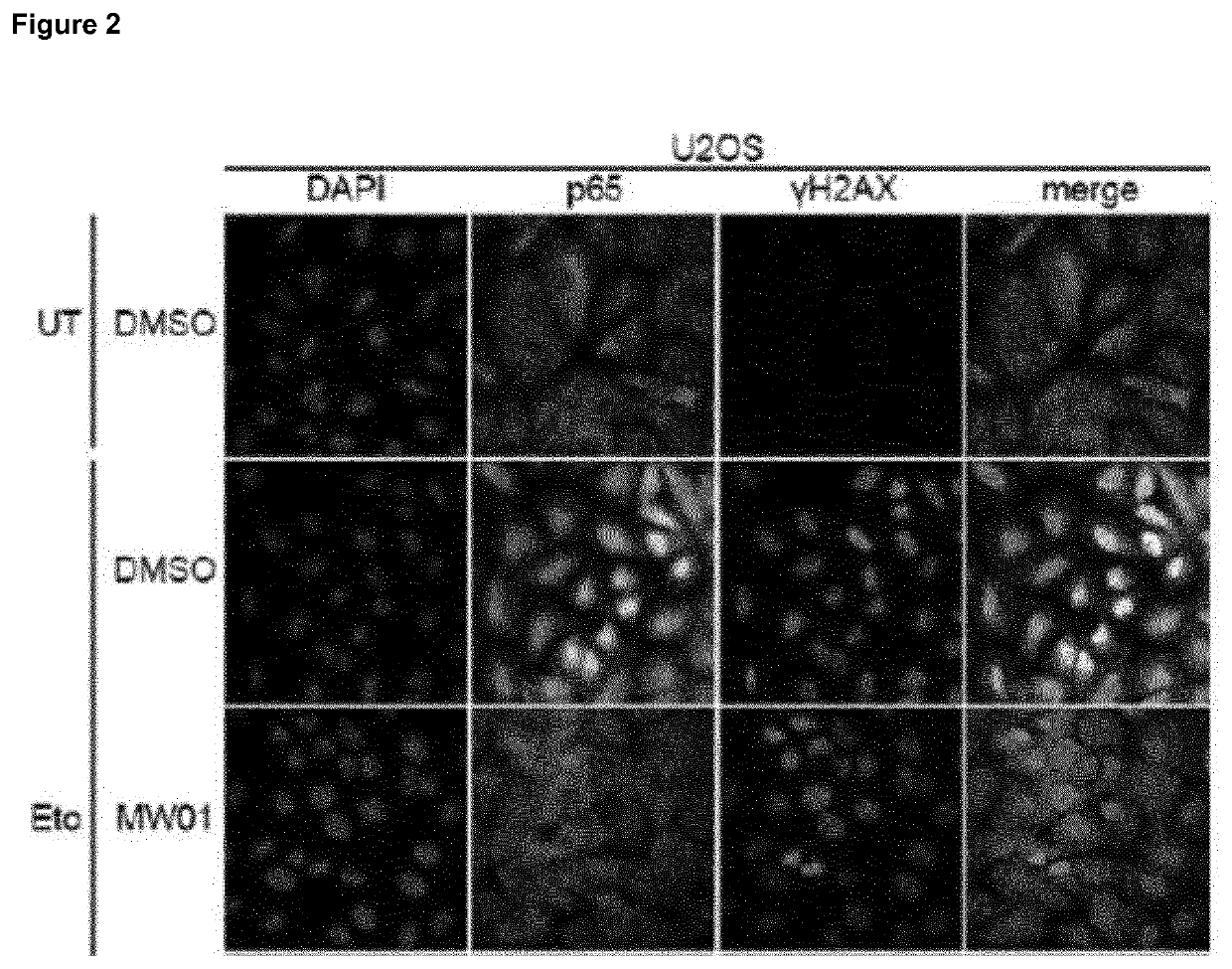 Selective inhibitors of gentotoxic steress-induced IKK/NF-κB pathways