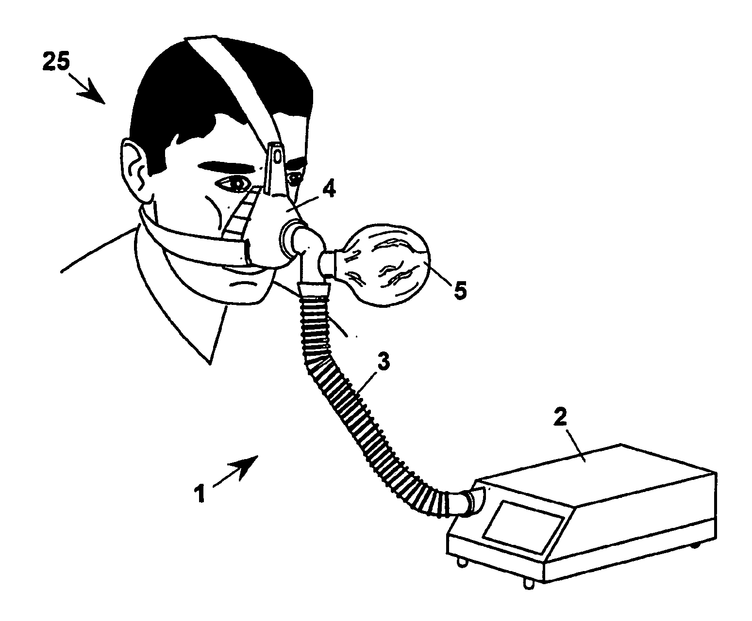 Apparatus for non-invasive mechanical ventilation