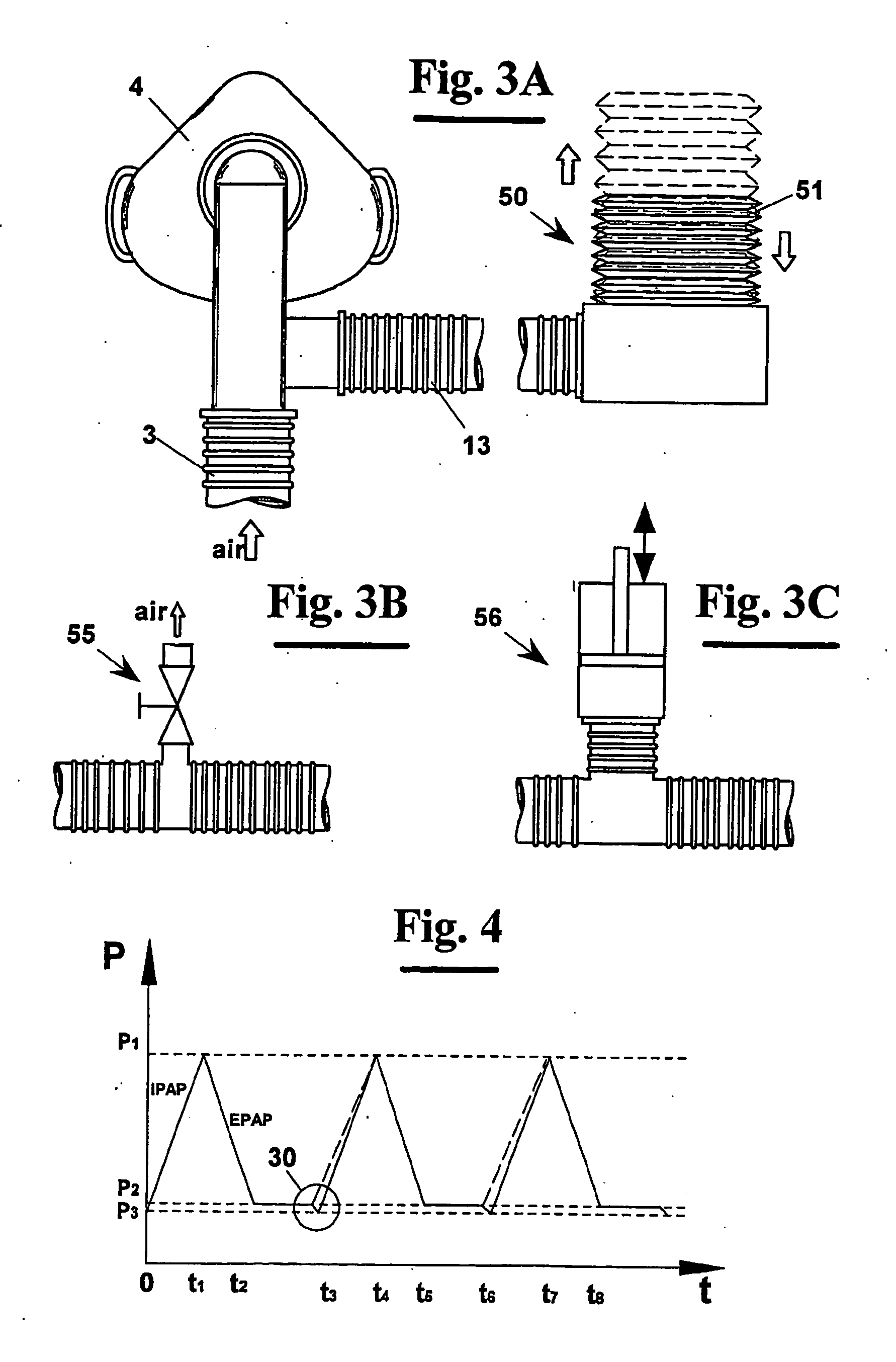 Apparatus for non-invasive mechanical ventilation