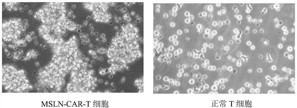 Preparation method of Mesothelin chimeric antigen receptor modified T cell with targeted high-intensity tumor killing activity