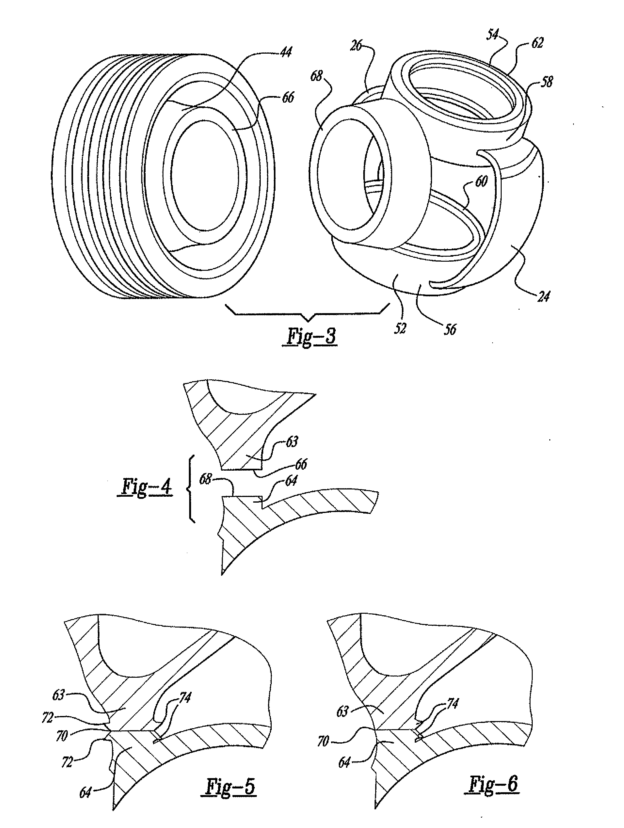 Load-optimized interior of a piston