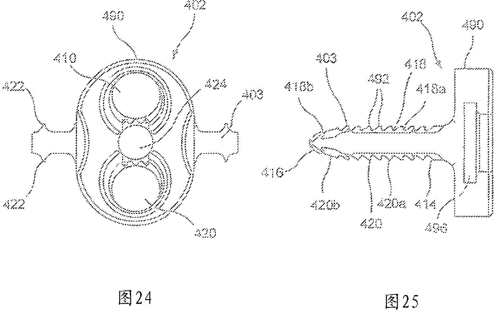 Intervertebral Interference Implants and Instruments