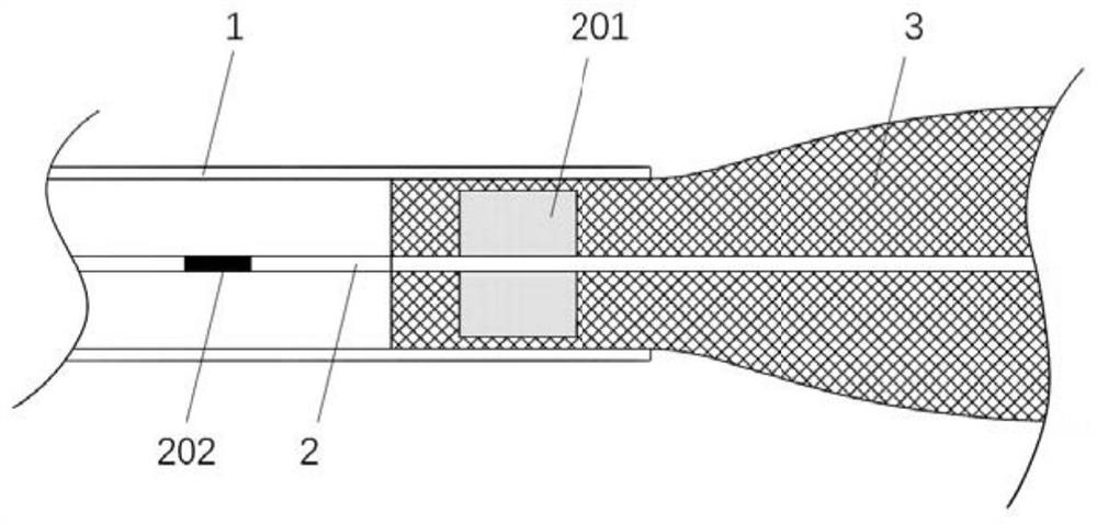 Endovascular implant fixation retention structure and endovascular implant delivery system