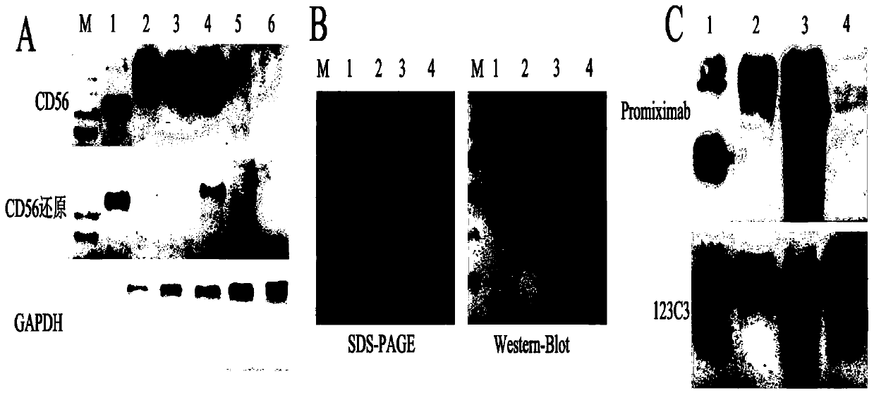 Anti-cd56 antibody and dolastatin coupling complex and its preparation method and use