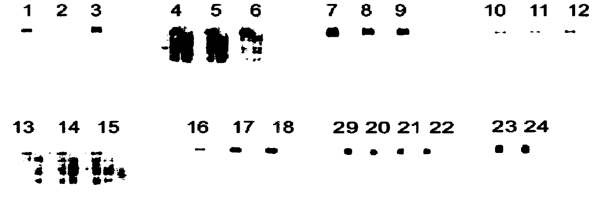 Anti-cd56 antibody and dolastatin coupling complex and its preparation method and use