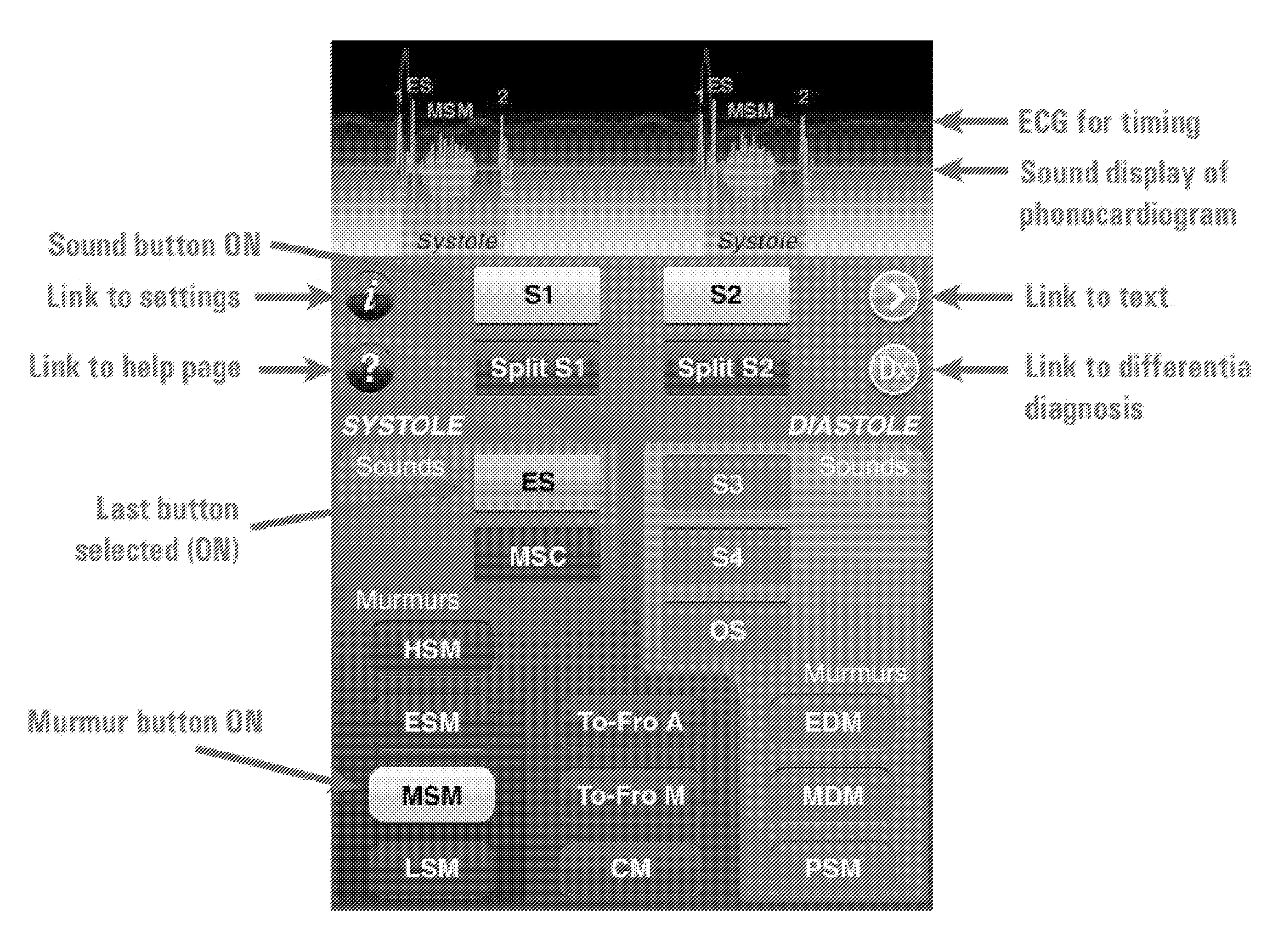 Method and system for identifying cardiopulmonary findings by using a heart and lung sounds builder