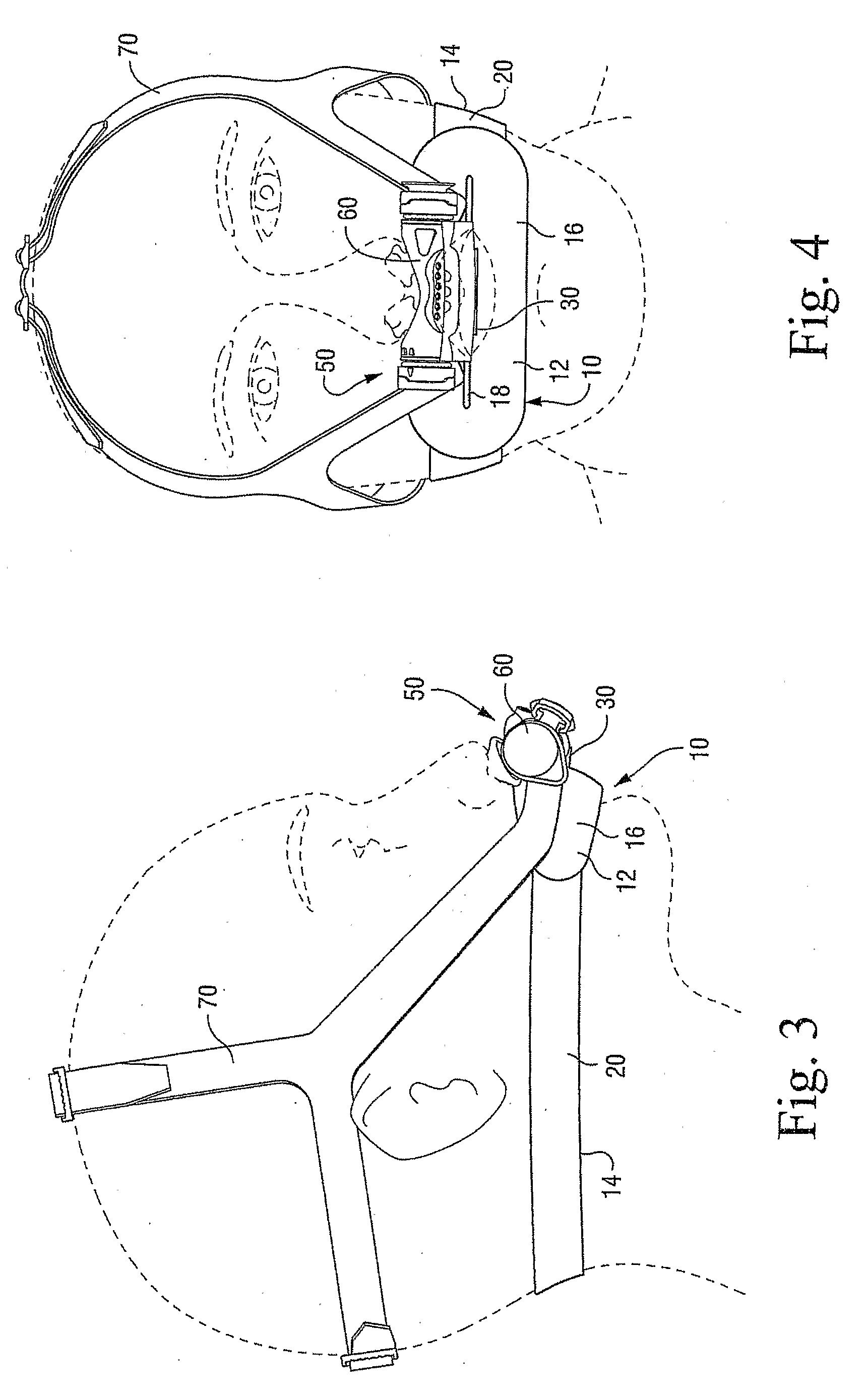 Mouth Seal Assembly for Nasal Mask System