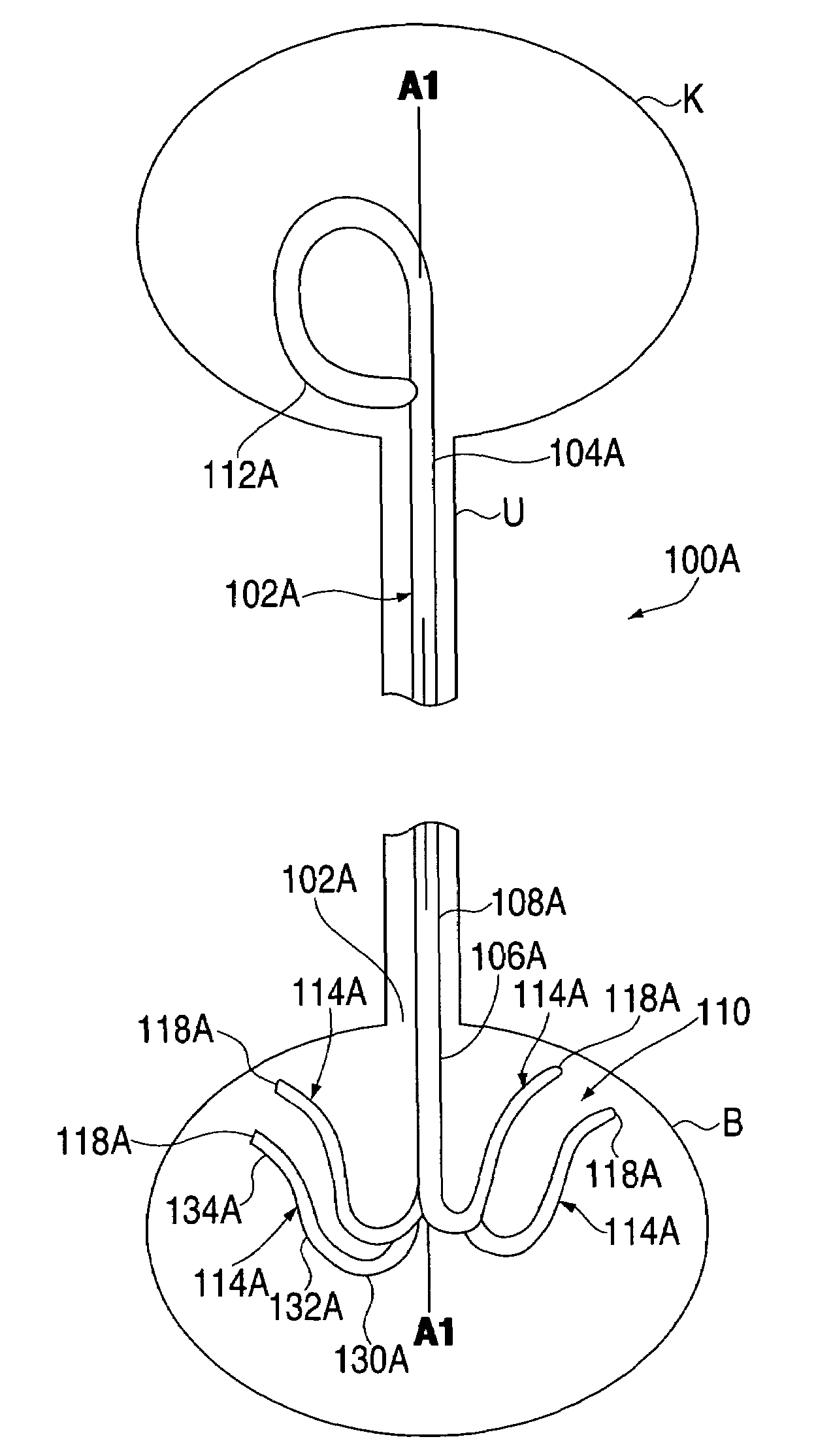 Ureteral stent with conforming retention structure