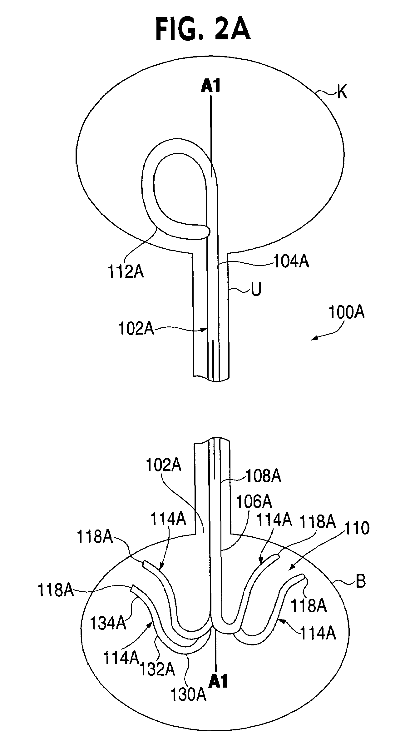 Ureteral stent with conforming retention structure