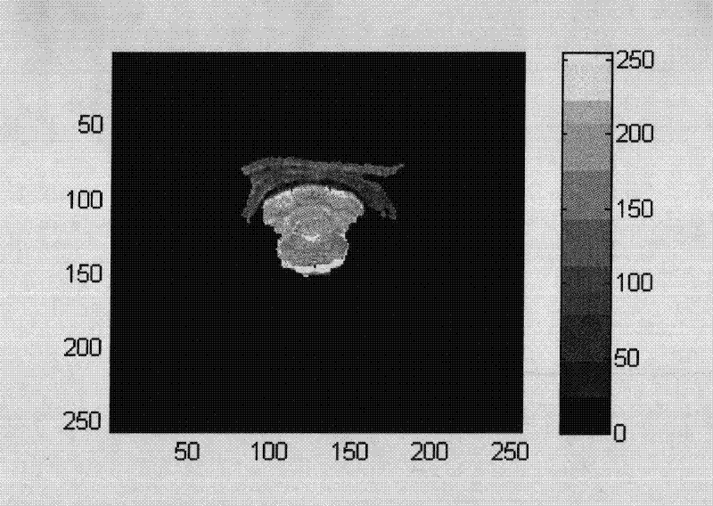 Obtaining method of rat head magnetic resonance image Monte Carlo simulation model