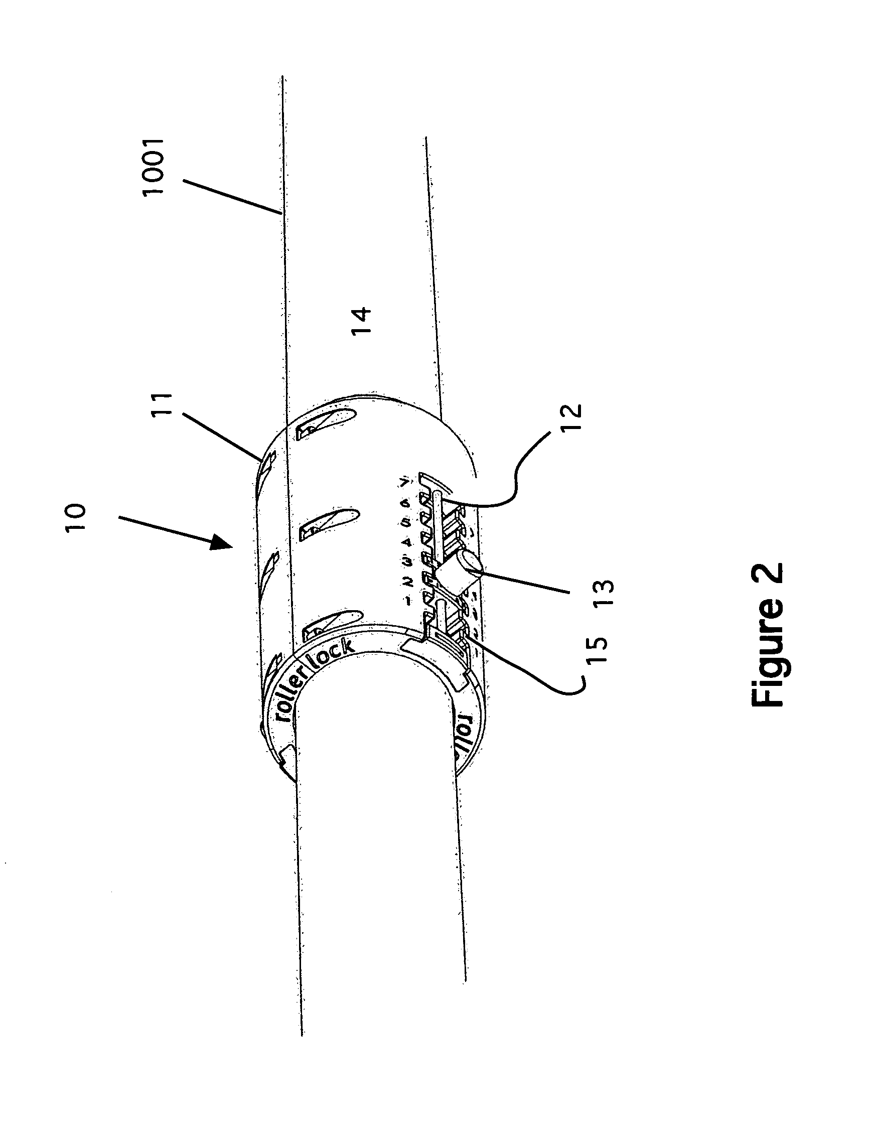 Oarlock system