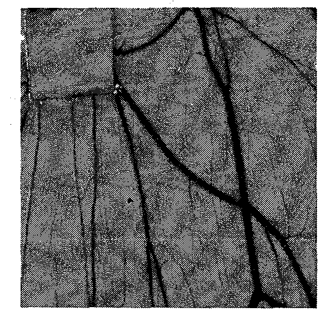 Quinazolinone vasoinhibitors, and preparation method and medical application thereof