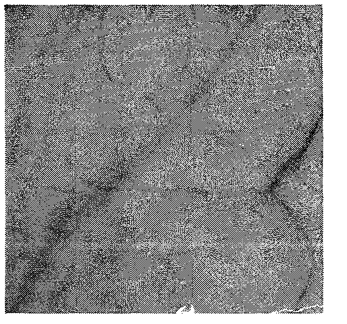 Quinazolinone vasoinhibitors, and preparation method and medical application thereof