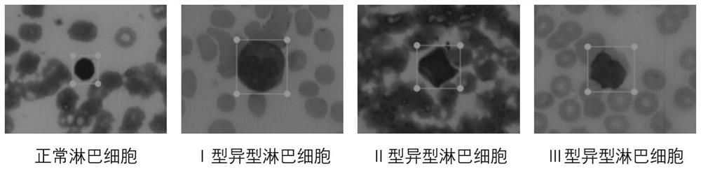 Heterotypic lymphocyte typing method based on YOLOv5 and microscopic hyperspectral image