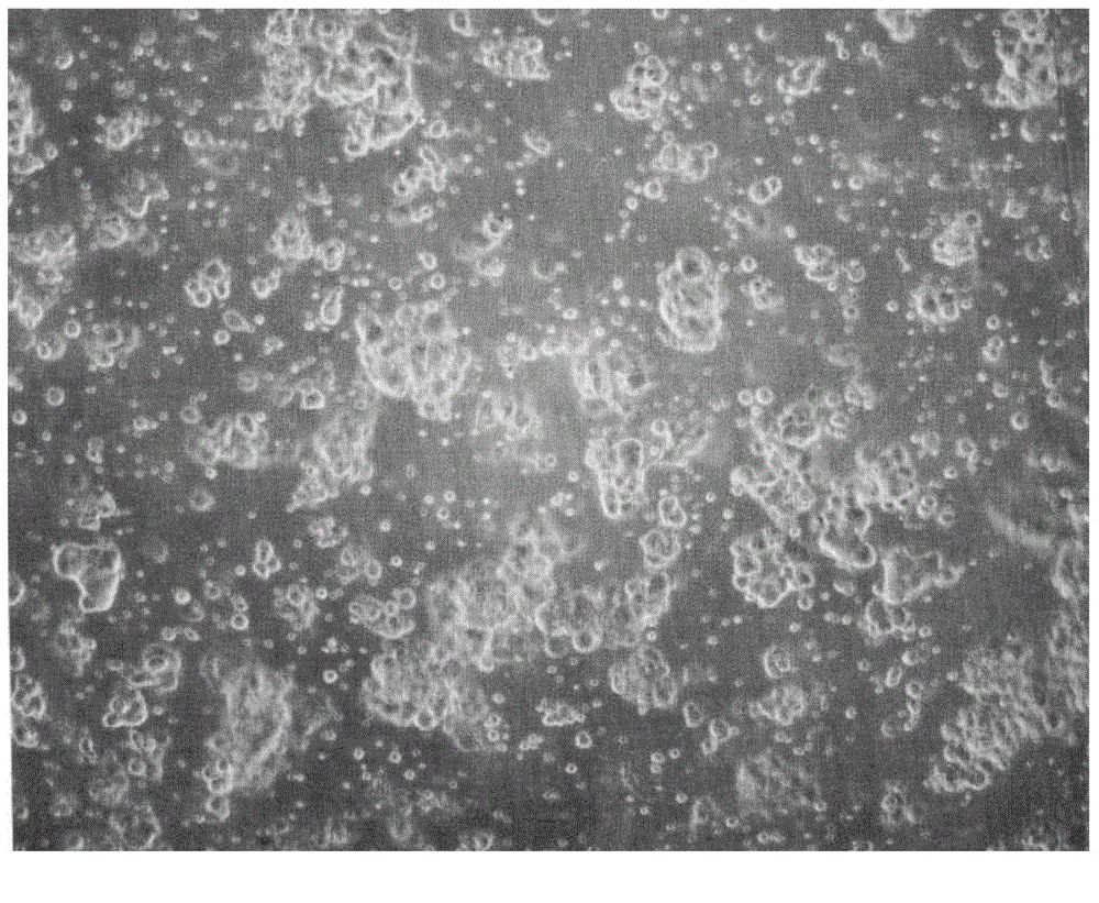 Method of quickly separating breast cancer primary tumor living cell