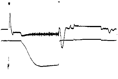 High-power bipolar pulse formation circuit integrated with high-voltage burst pulse preionization