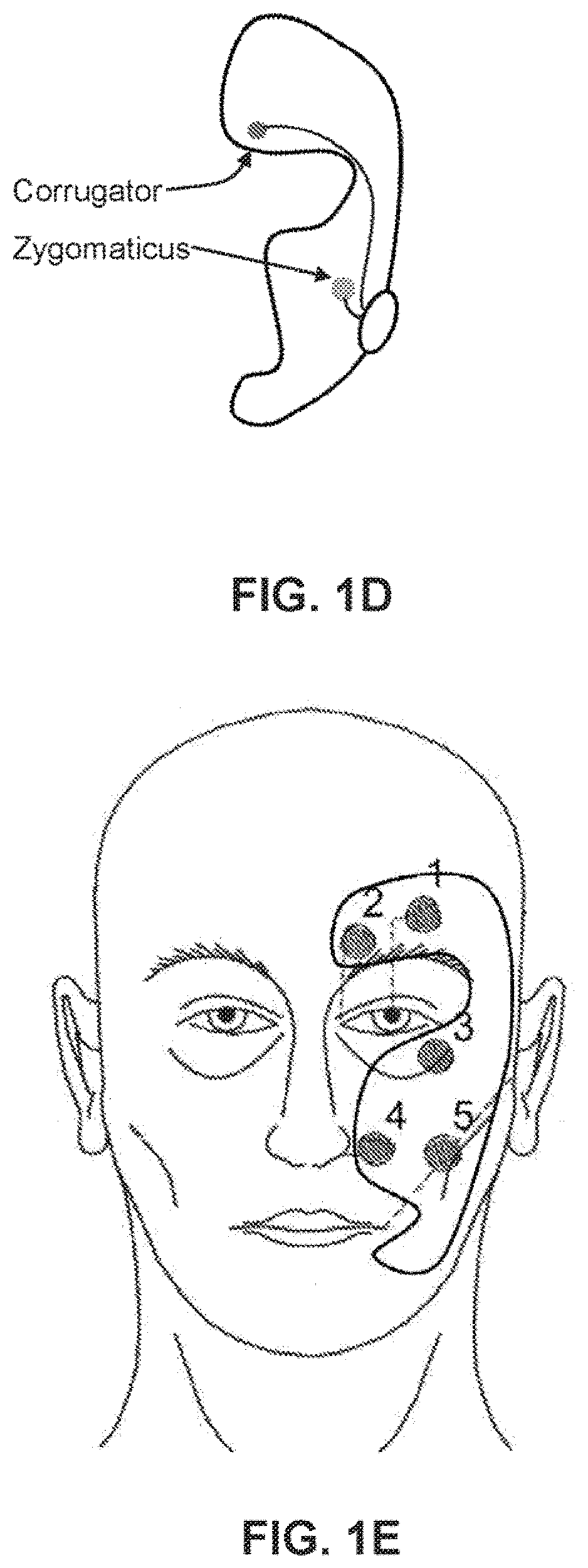 Pain assessment method and apparatus for patients unable to self-report pain