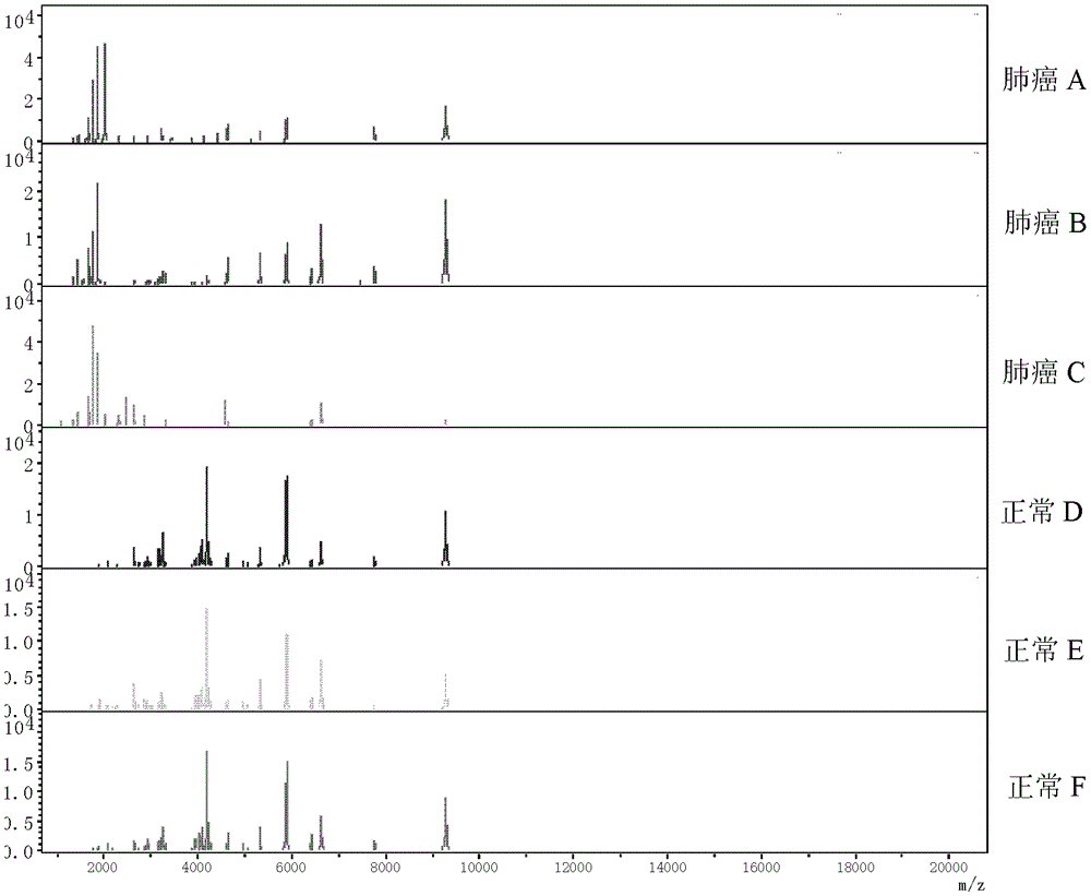 A set of signature proteins used to detect lung cancer