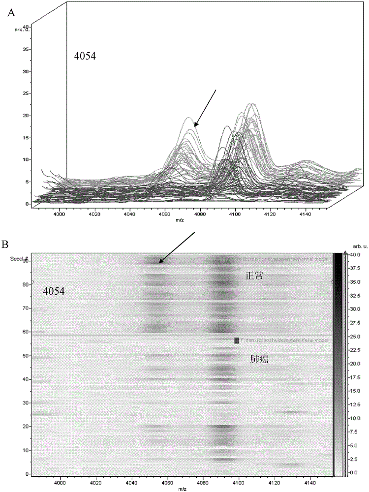 A set of signature proteins used to detect lung cancer