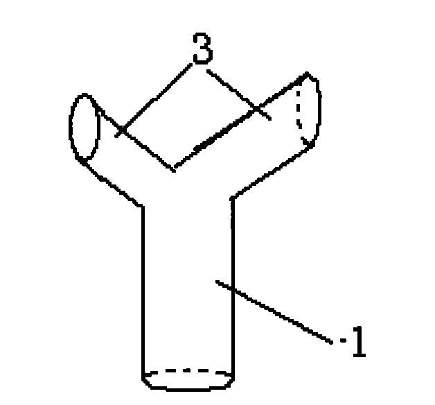 Preparation method of absorbable stent in cerebral vascular bypass surgery and angioplasty