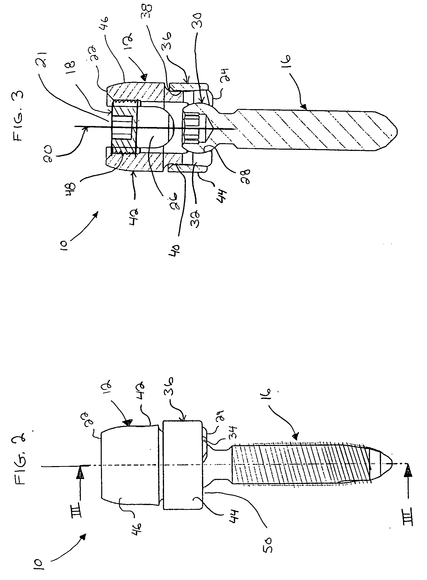 Polyaxial bone anchor and method of spinal fixation