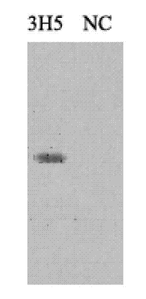 Brucella B cell epitope and monoclonal antibody and application thereof