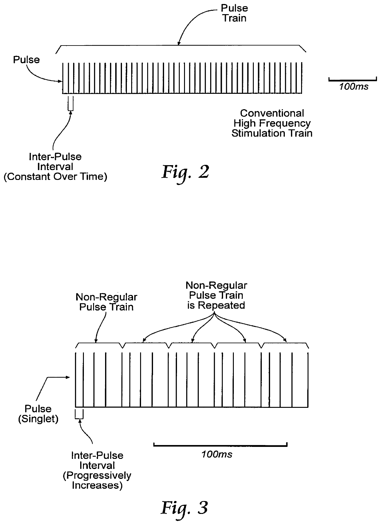 Non-regular electrical stimulation patterns for treating neurological disorders