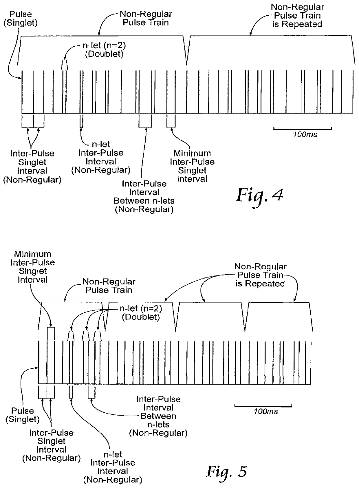 Non-regular electrical stimulation patterns for treating neurological disorders