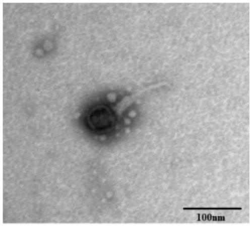 New klebsiella pneumoniae phage and application thereof