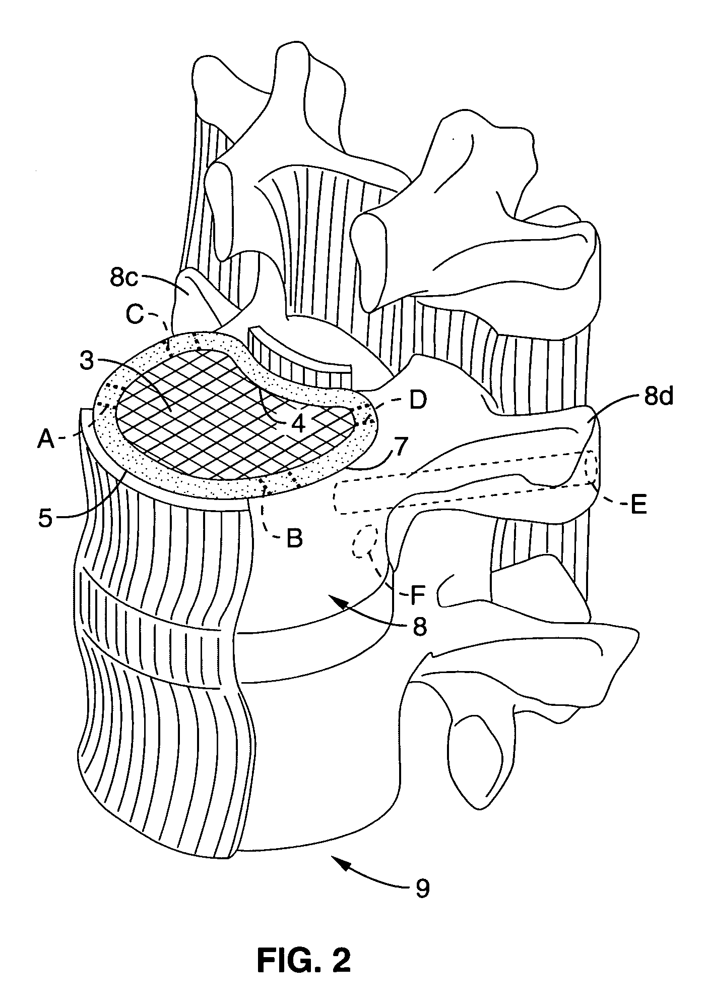 System and method providing directional ultrasound therapy to skeletal joints